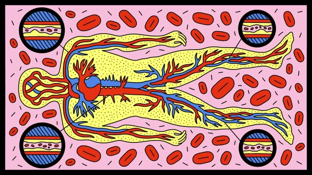 <p>CHOLESTEROL COMPLEXITY</p><p>For years we were told cholesterol was simple: LDL bad, HDL good. But new research shows the reality is a chaotic lipoprotein ecosystem, where some overlooked particles — like lp(a) and “remnants” — are far more dangerous than standard cholesterol tests reveal, and HDL itself can turn troublesome at very high levels. As scientists unravel this molecular cast of villains and impostors, the old cholesterol rules are being rewritten, with apolipoprotein-B counts now looking like the real measure of heart risk.</p><p></p><p>sorry paywalled again:</p><p><a target="_blank" rel="noopener noreferrer nofollow" href="https://www.economist.com/science-and-technology/2025/11/25/theres-more-to-cholesterol-than-simply-good-or-bad?utm_content=ed-picks-image-link-1&etear=nl_today_1&utm_campaign=r.the-economist-today&utm_medium=email.internal-newsletter.np&utm_source=salesforce-marketing-cloud&utm_term=11/25/2025&utm_id=2146291">https://www.economist.com/science-and-technology/2025/11/25/theres-more-to-cholesterol-than-simply-good-or-bad?utm_content=ed-picks-image-link-1&etear=nl_today_1&utm_campaign=r.the-economist-today&utm_medium=email.internal-newsletter.np&utm_source=salesforce-marketing-cloud&utm_term=11/25/2025&utm_id=2146291</a></p>