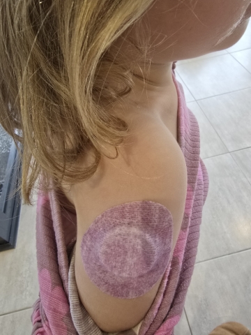<p>Once the tool is completed, it can be thrown away</p><p><br></p><ul><li>Press around the sensor to ensure it stuck firmly</li><li>Take a Plaster patch, and place over the whole sensor to protect it.</li></ul>