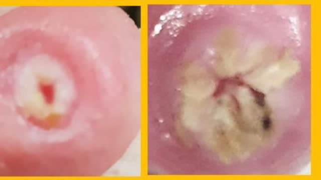 <p>Poor teat end conditions are still very common. Hyperkeratosis in herds should always be less than 20% rough (score 3) and very rough (score 4). Target to have over 95% of teats in score 1 & 2 and closed after milking!</p>