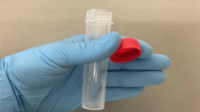 <p>Remove the lid, taking care not to touch the inside of the lid or sample tube. Hold the lid between thumb and finger.</p>