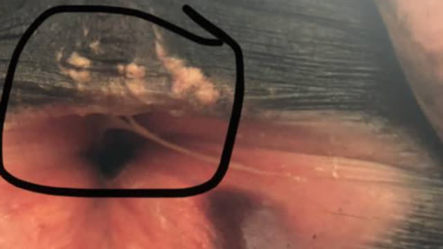 <p>The top of the vulva is split like this.</p>

