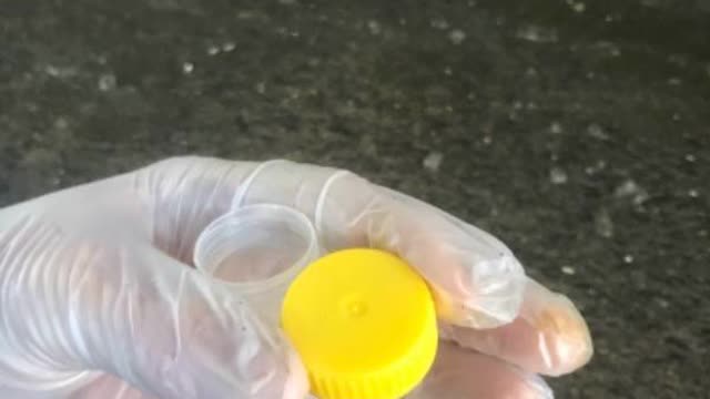 <p>Undo the sample container and hold cap like this.
DON'T put the cap down.</p>
