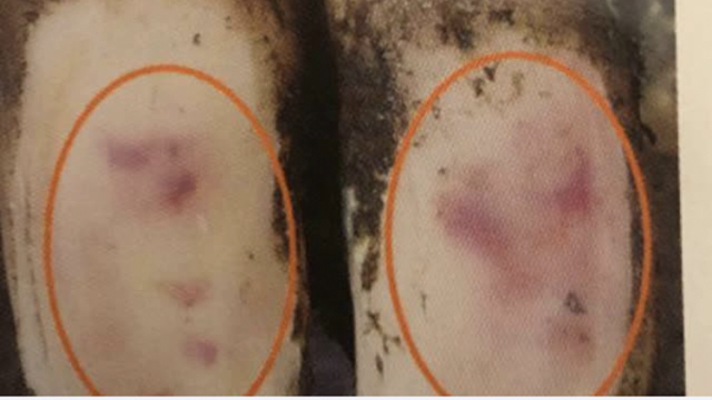 <p><a href="https://knowby.show/00974983-8f9d-4421-8333-c41631517ca5">Bruising</a> is common in heifers particularly at calving time.</p>