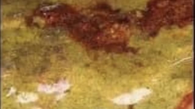 <p>Salmonella
Bacterial
5-14 days</p>