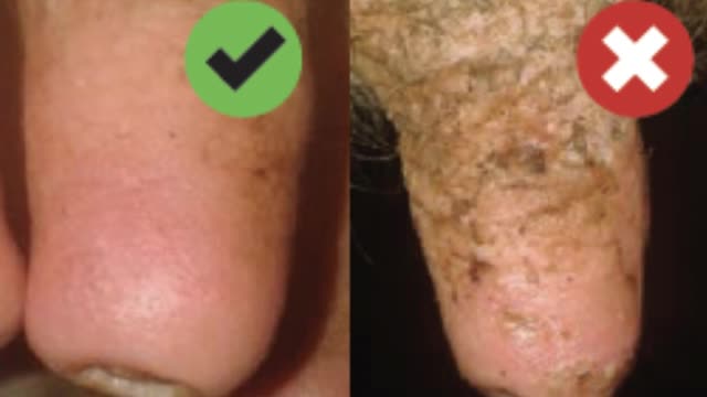 <p>The emollient helps keep the skin soft and crack free ( especially when it’s wet ). Bacteria can live in the cracks!
And it hurts cows when you milk dry, cracked teats.</p>