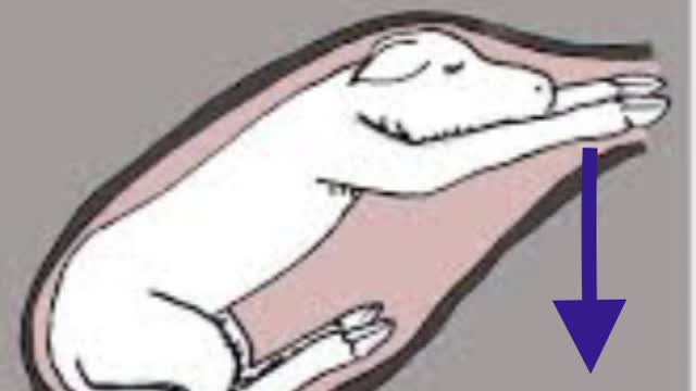 <p>In a “normal presentation” these claws will be facing towards the ground when the front feet come out - therefore they have to be front feet</p>